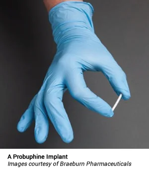 A Probuphine Implant: Images courtesy of Braeburn Pharmaceuticals
