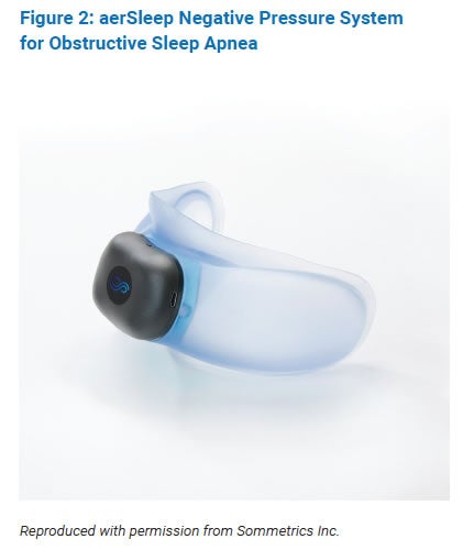 Figure 2: aerSleep Negative Pressure System
for Obstructive Sleep Apnea