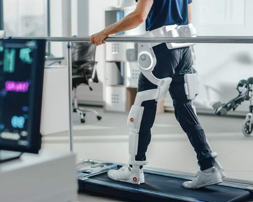 Person walking on treadmill with exterior prosthetics